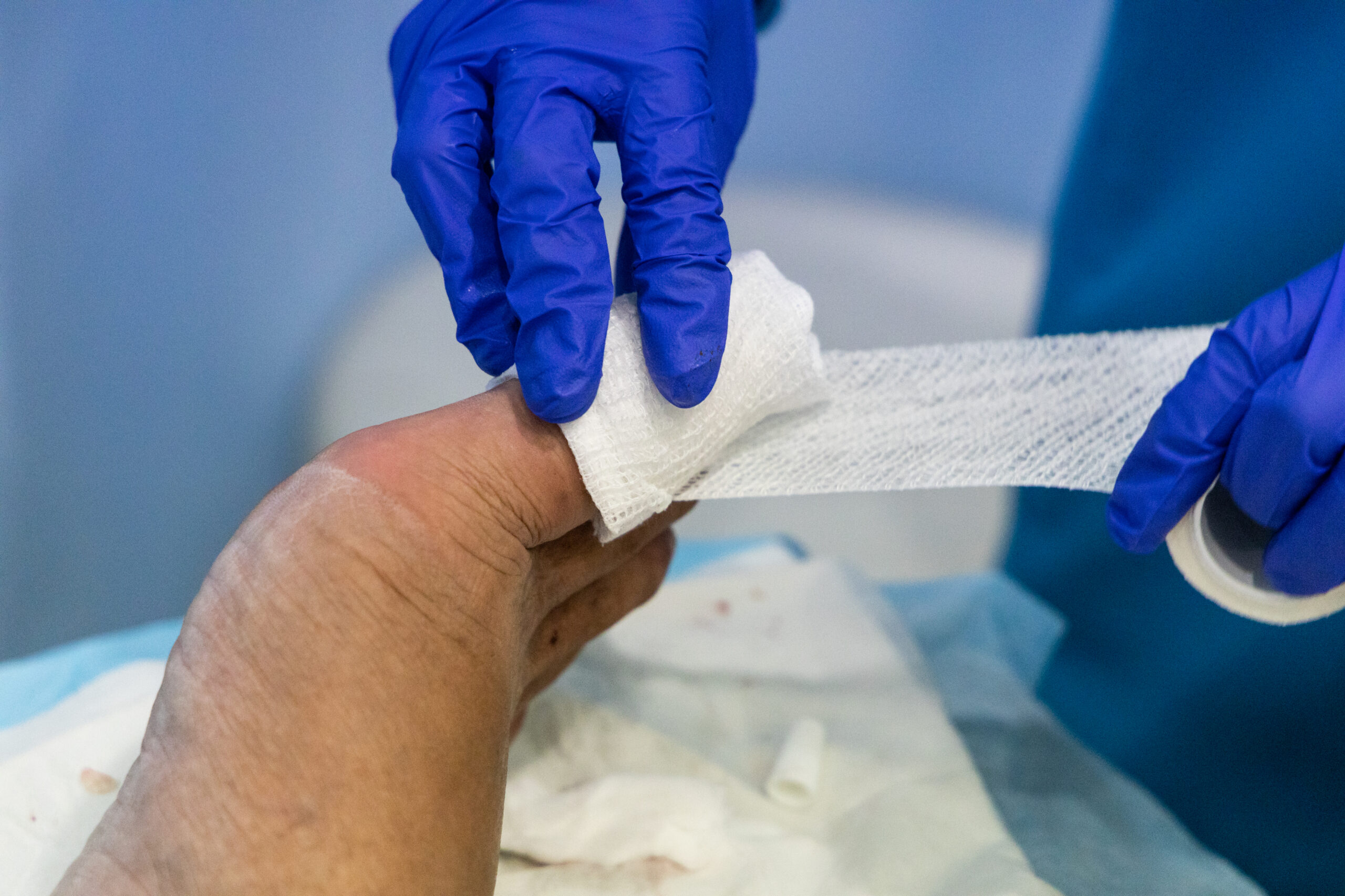 Behandlungspflege – Wundversorgung und Verbandwechsel zu Hause